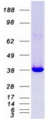 Coomassie blue staining of purified MAPK14 protein.